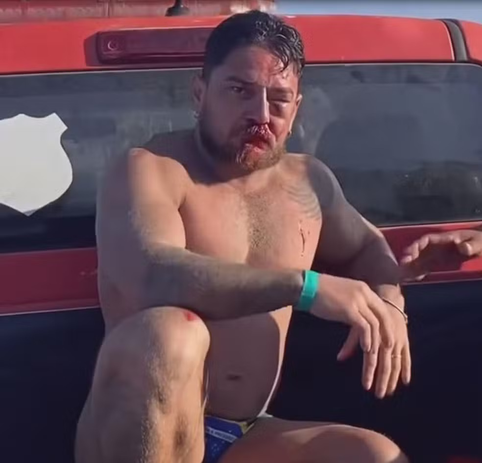 Turista de Mato Grosso é agredido em Porto de Galinhas - Foto (Reprodução-WhatsApp)