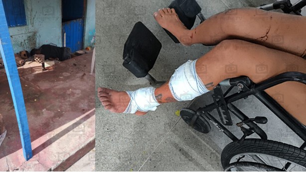 Usuário de drogas é assassinado e mulher é baleada em Pedras de Fogo - Reprodução1