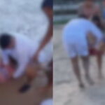 Dois ataques de tubarão em 48 horas deixam jovem e criança com amputações no litoral de Pernambuco